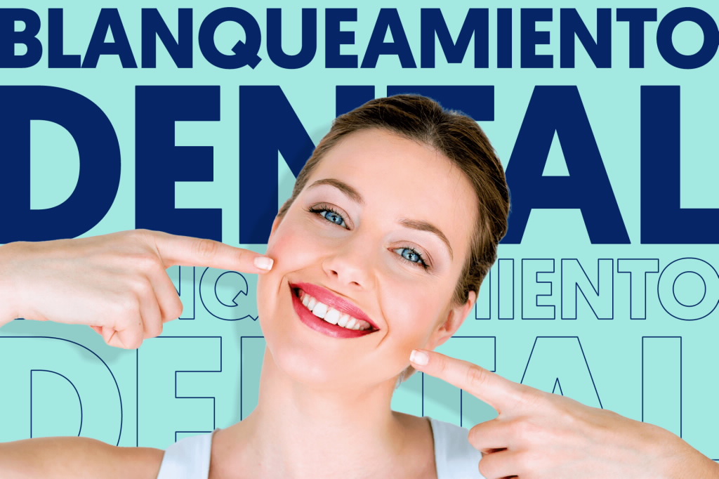 Cuidados después del blanqueamiento dental